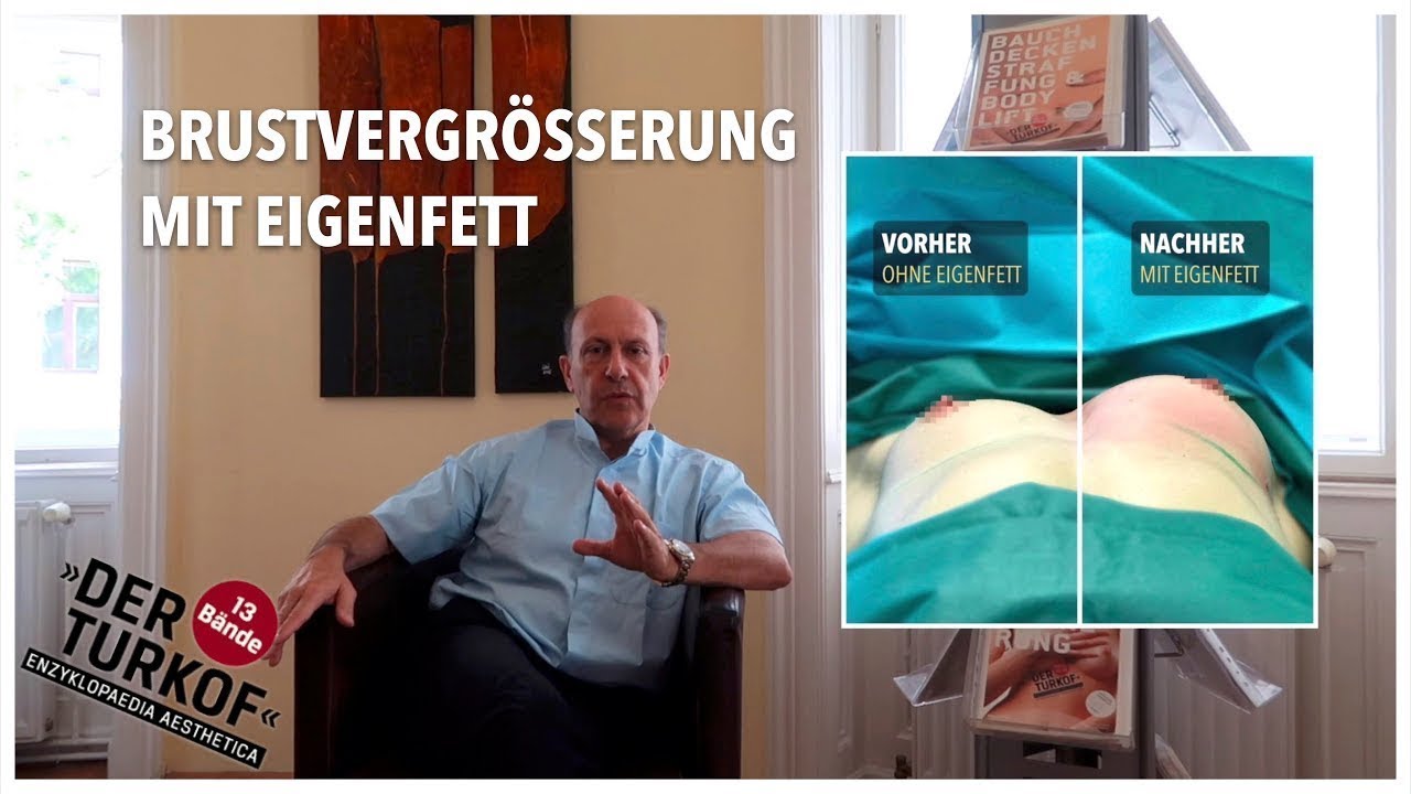 33++ Brustrekonstruktion mit eigenfett bilder , Brustvergrößerung mit Eigenfett Univ.Prof. Dr. Edvin Turkof