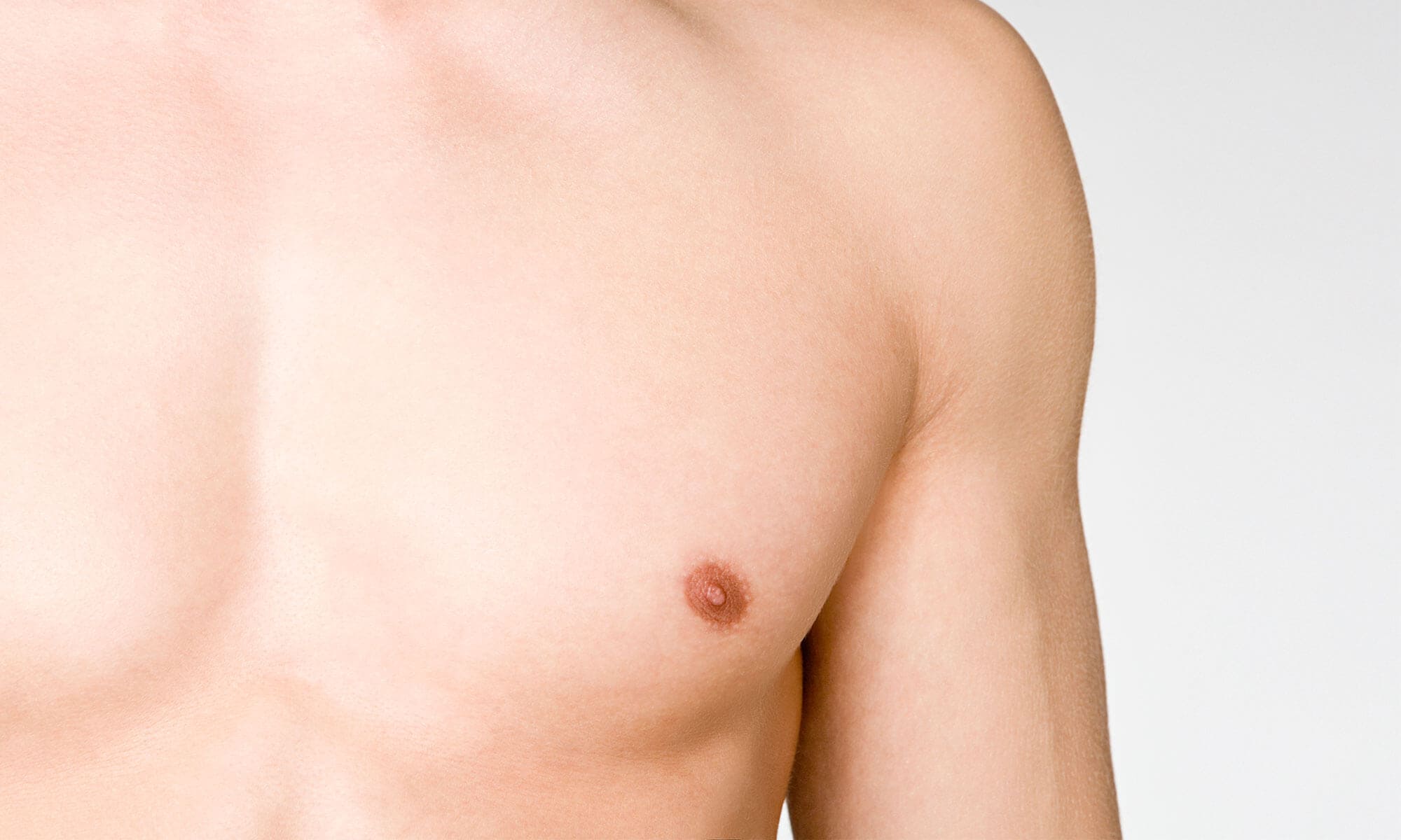 уплотнение под кожей в груди у мужчин фото 8